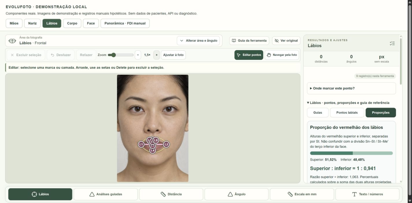 Componente real do Evolufoto com pontos labiais manuais e painel de proporção do vermelhão superior e inferior.